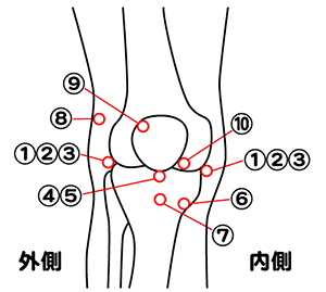 膝の痛みの場所から分かる膝の症状